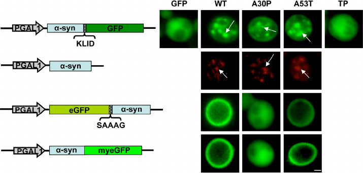 A30P-synuclein-aggregate-formation-upon-high-copy-expression-in-yeast-Live-cell (1).png