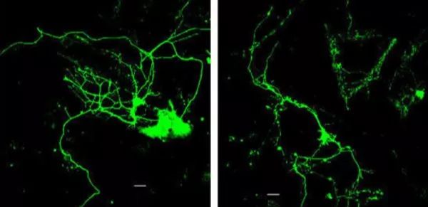 pCAGGS质粒转染小鼠原代神经元